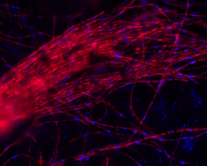 FISH image of A. richmondensis in red, with DAPI-stained DNA from all microbial community members in blue. Field sample
from Richmond Mine at Iron Mountain, CA. Picture by Chris Miller