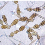 Alternaria alternata