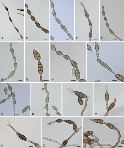 Alternaria sect. Alternata: conidia and conidiophores.
