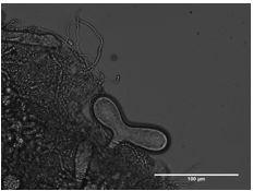 Anaeromyces sp. S4. Photo credit: John Henske