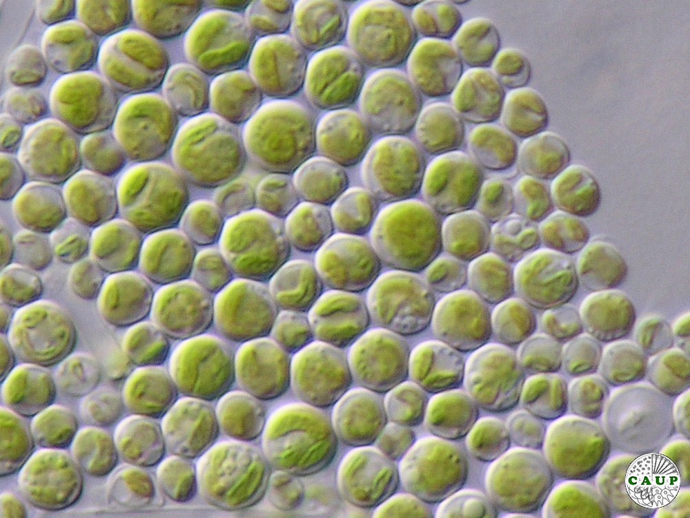 Auxenochlorella protothecoides