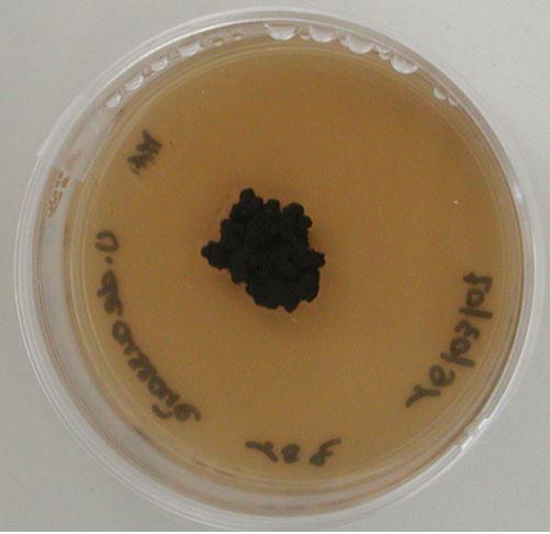 Chaetothyriales sp. MNA-CCFEE 5317 grown on MEA. Images courtesy of Laura Selbmann.