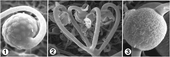 Figs 1 and 2) Multispored sporangia borne terminally on circinate and umbellate sporangiophores. Fig 3) Zygospores between opposed suspensors. Images by Kerry O'Donnell.