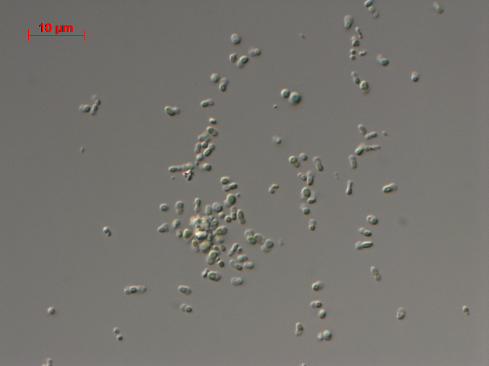 Photo of Cyanidiococcus yangmingshanensis 8.1.23 F7