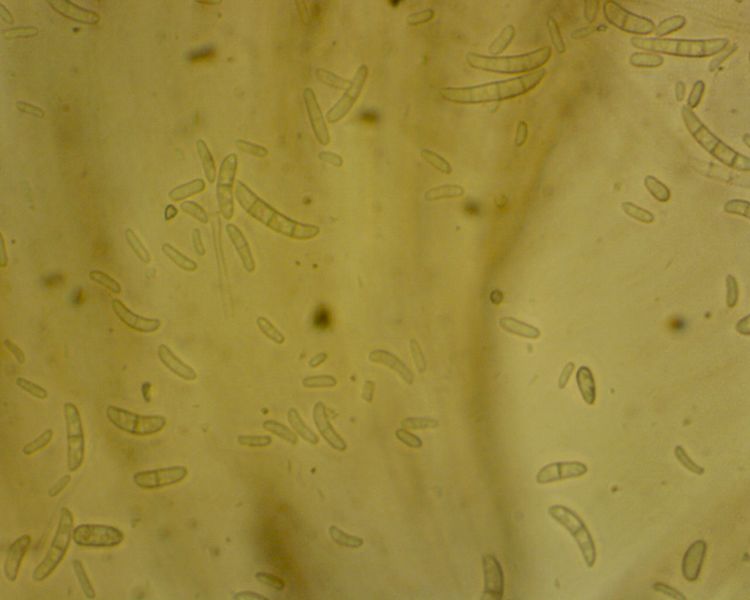 Fusarium Micro and Macro conidia