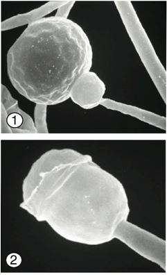 Figure 1) Distinct subsporangial swelling termed (apophysis) of Gongronella butleri. 
Figure 2) Hemispherical columella. 
Images by Kerrie O'Donnell