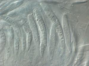 Asci and ascospores of Lophiostoma macrostomum.