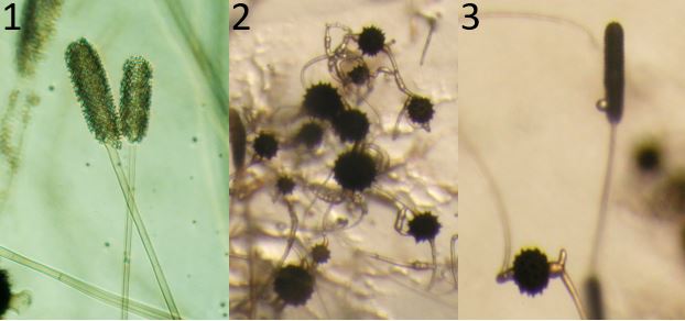 Figure 1) Mycotypha indica (strain 10x3463-300). Two typical vesicles covered with sporangiola. Figure 2) Mycotypha indica (strain 11x3399Z+-300). Zygospores on the agar surface. Figure 3) Mycotypha indica (strain 10x3400 Z+vesicle-300). A zygospore and
sporophore showing a side-by-side comparison of the size differences. Images by Gerald Benny.