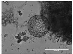 Neocallimastix californiae G1. Credit: John Henske