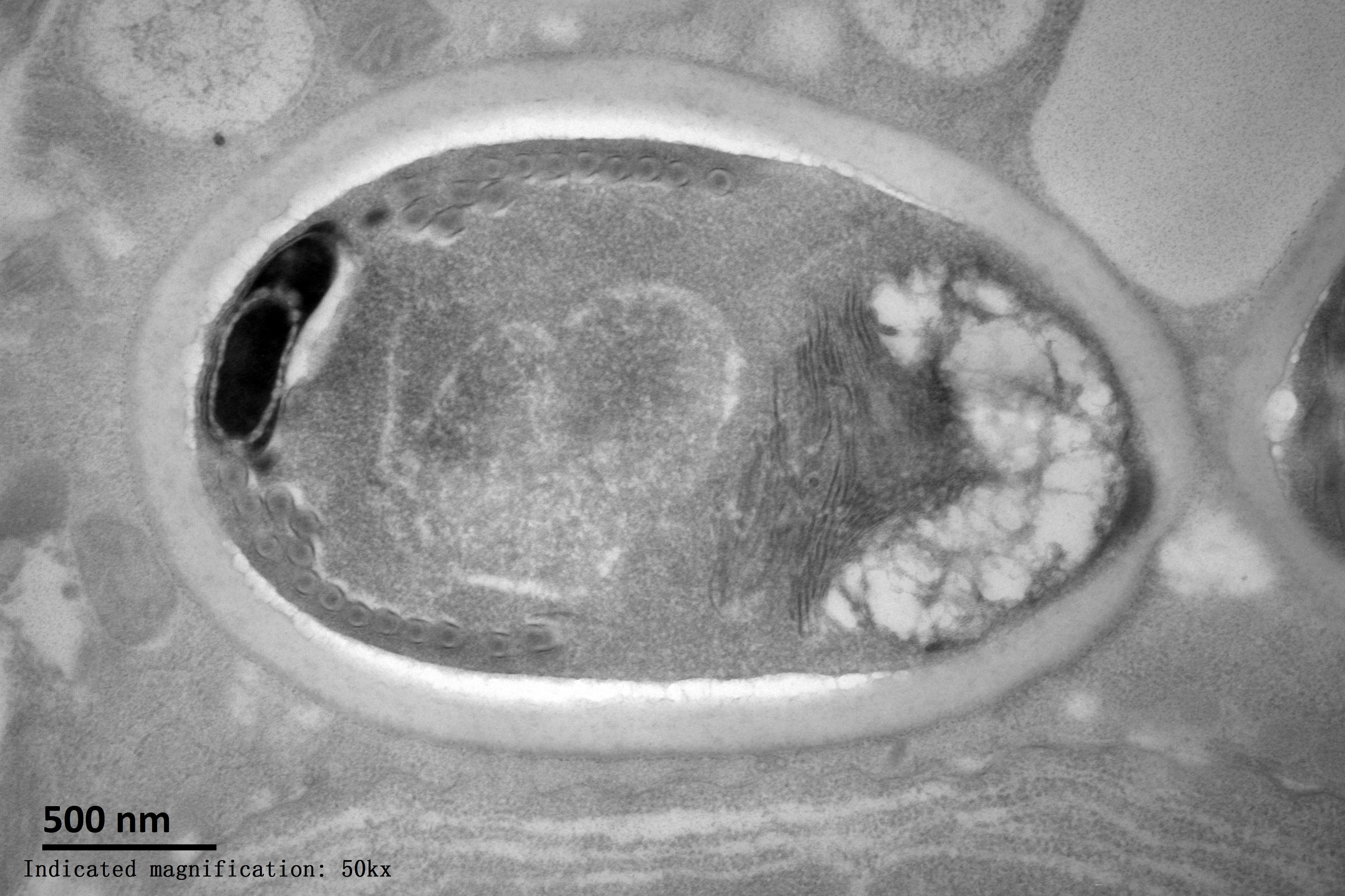 Photo of Nosema bombycis CQ1