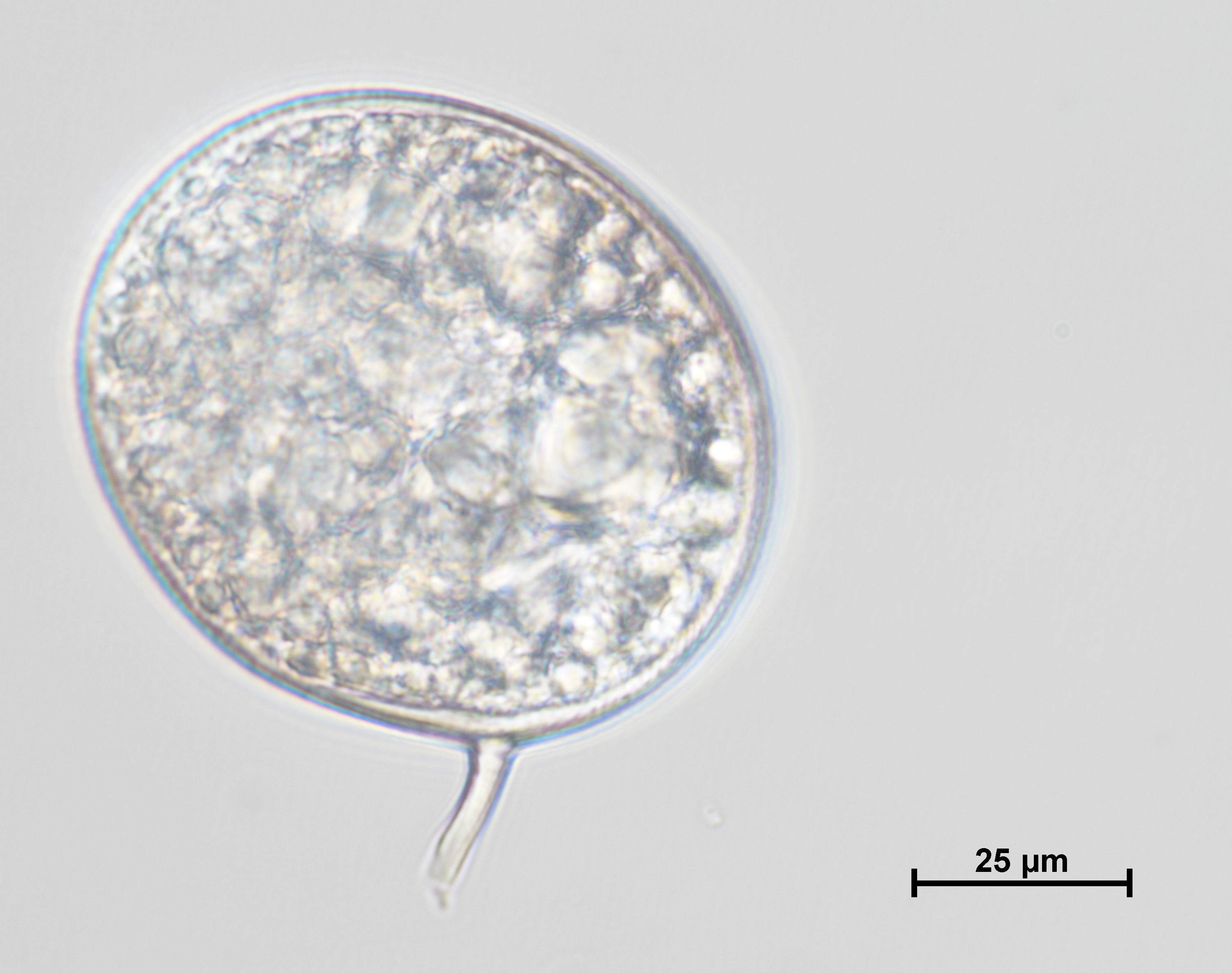 Paraglomus occultum