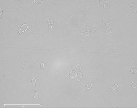 Scheffersomyces cryptocercus NRRL Y-48824T. Scale bar: 25 micrometers. Image by Katharina de Oliveira Barros.