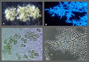 Trichoderma longibrachiatum
